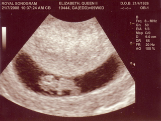 Ultrasound was still a promising new technology when the queen had her last child.
